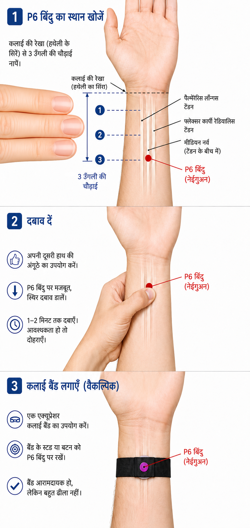 P6 Acupressure wristband placement